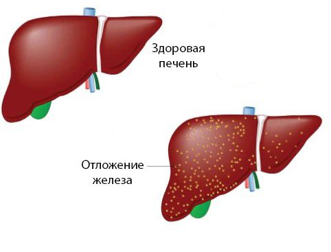 УЗИ поджелудочной железы