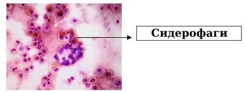Сидерофаги в лёгких [25]