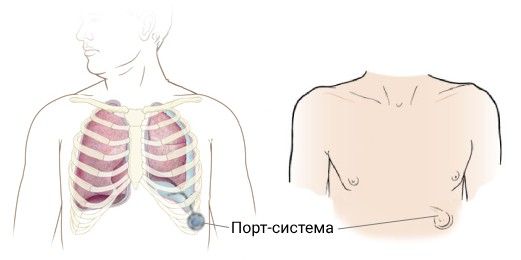 Канальный порт Канальный порт