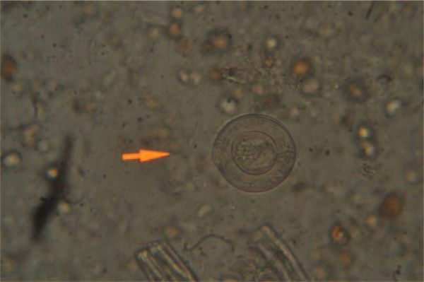 Гименолепис в кале [15]