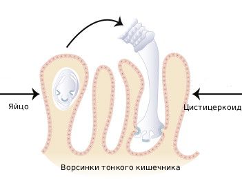 Гименолепис в тонком кишечнике