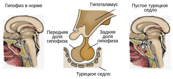 Пустое турецкое седло