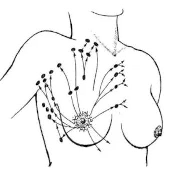Отводящие лимфатические пути молочной железы