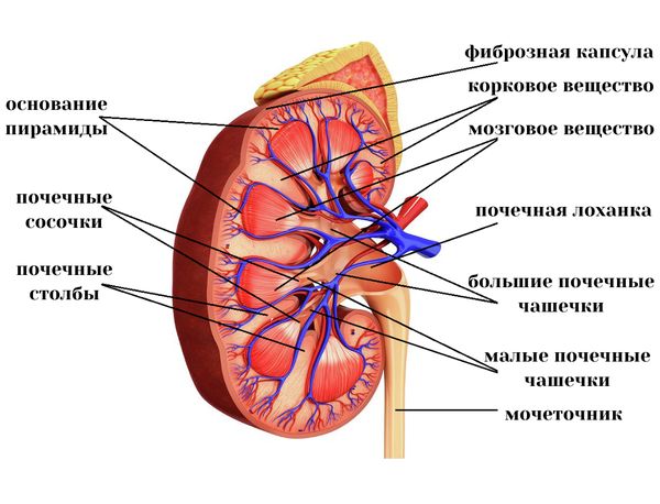 Вторично сморщенная почка.