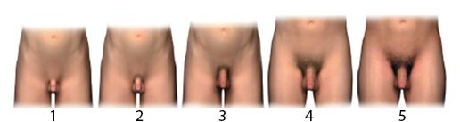 Шкала Таннера. Нормальное половое развитие [12]