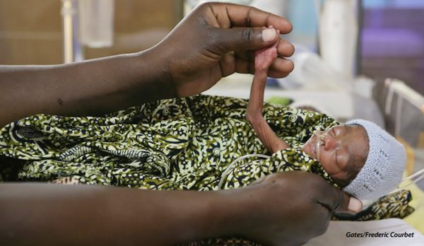 Ребёнок с низким весом при рождении [13]