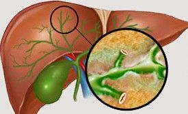 Холестаз развивается из-за нарушения оттока желчи