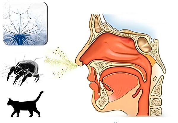 Аллергический ринит
