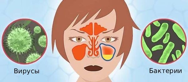 Инфекционные агенты в полости носа