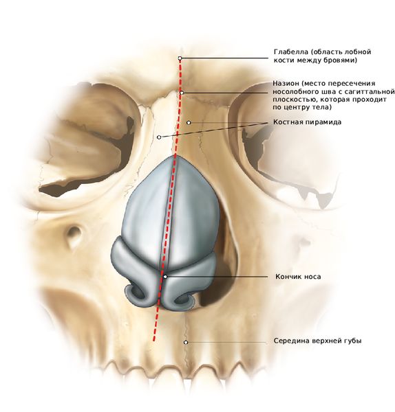 Искривление носа в одну сторону