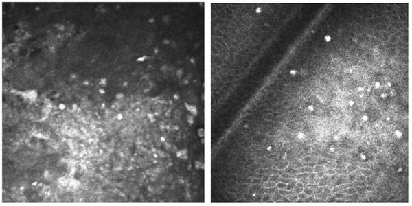 Акантамёба при конфокальной микроскопии [24]