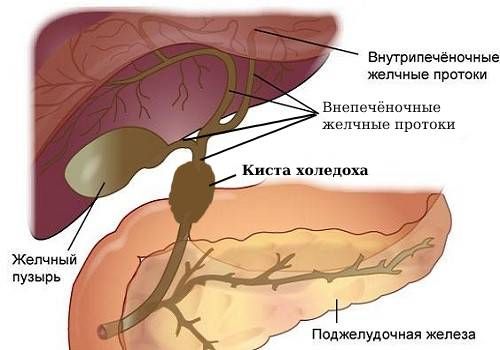Лечение стриктур желчных протоков в Москве, цена | Хирургия печени