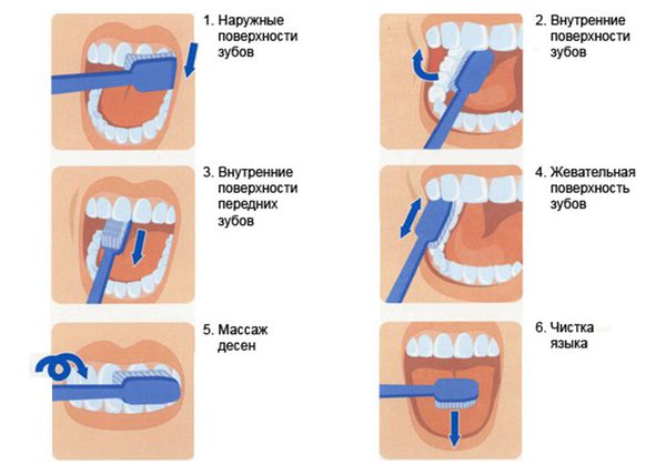 Правильная техника чистки зубов