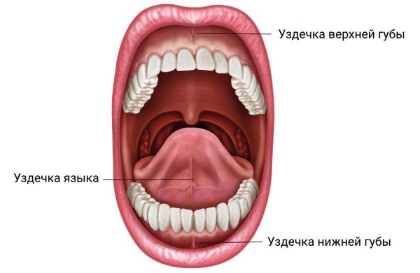 Короткая уздечка верхней губы