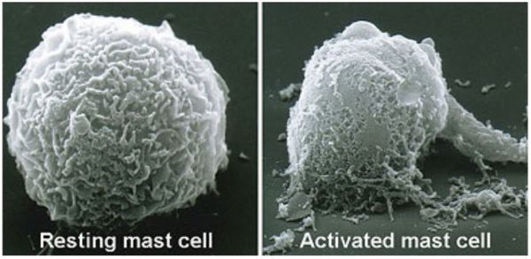 Активация тучных клеток