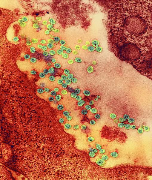 Вирус краснухи в организме человека