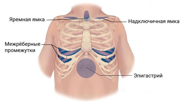 Гломусные опухоли шеи (параганглиома)