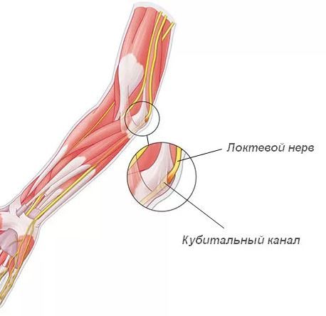 Кубитальный канал