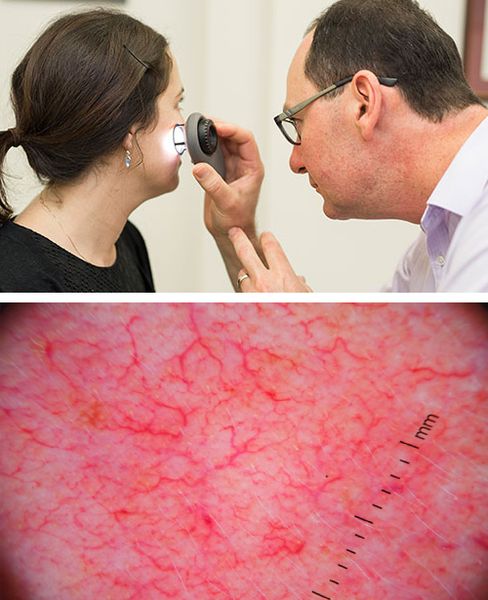 Дерматоскопия [13][14]