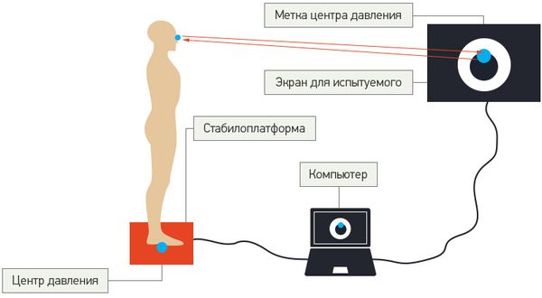 Стабилоплатформа