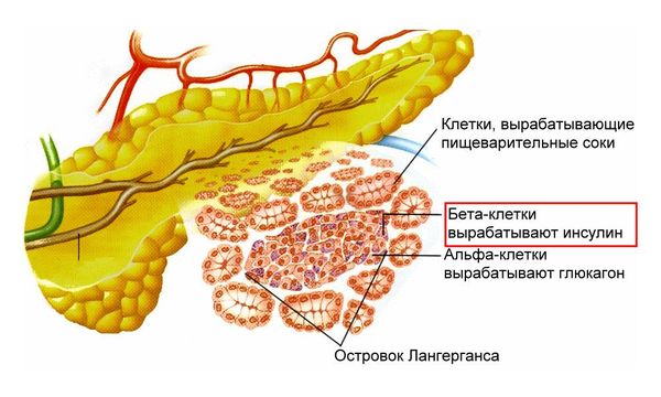 LADA-диабет