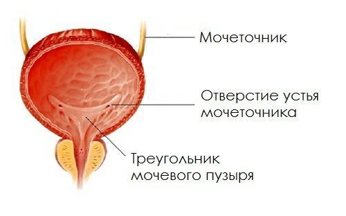 Кистозно-железистая метаплазия мочевого пузыря