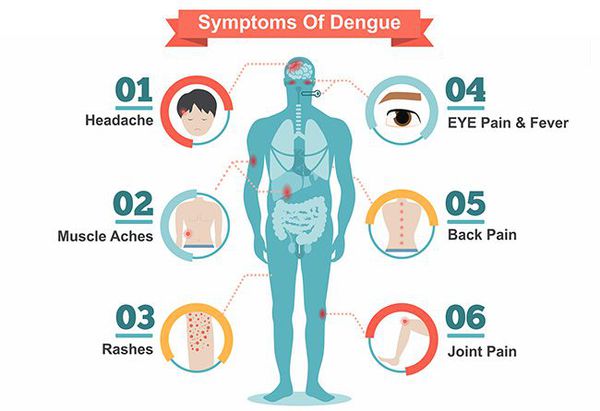 Симптомы лихорадки Денге