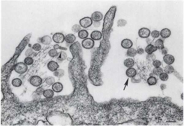 Микрофотография хантавирусов на среде Vero E6