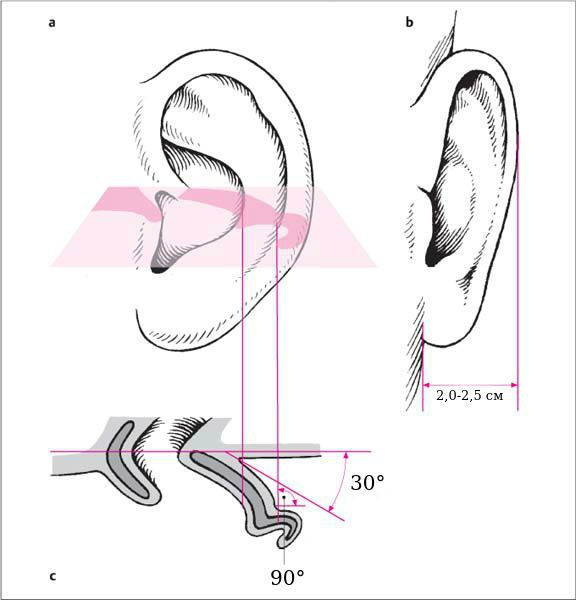 Нормальная анатомия наружного уха