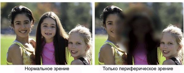 Как видит человек с центральным зрением и без него [26]