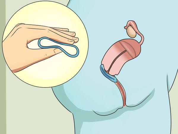 vaginalnoe kolco s