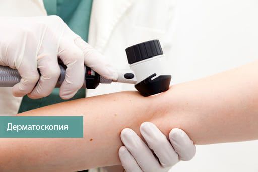 dermatoskopiya s