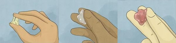 Признаки патологического отделяемого из половых путей