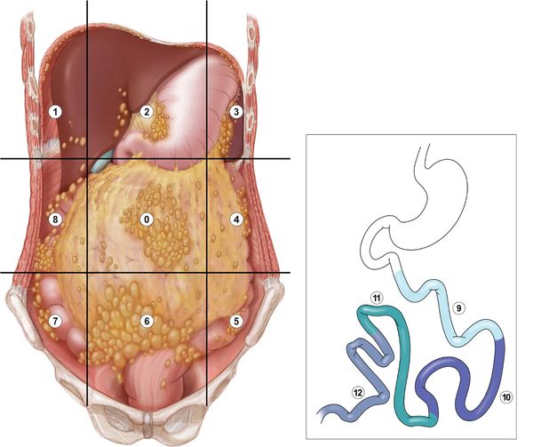 Зоны брюшной полости и тонкой кишки [15]