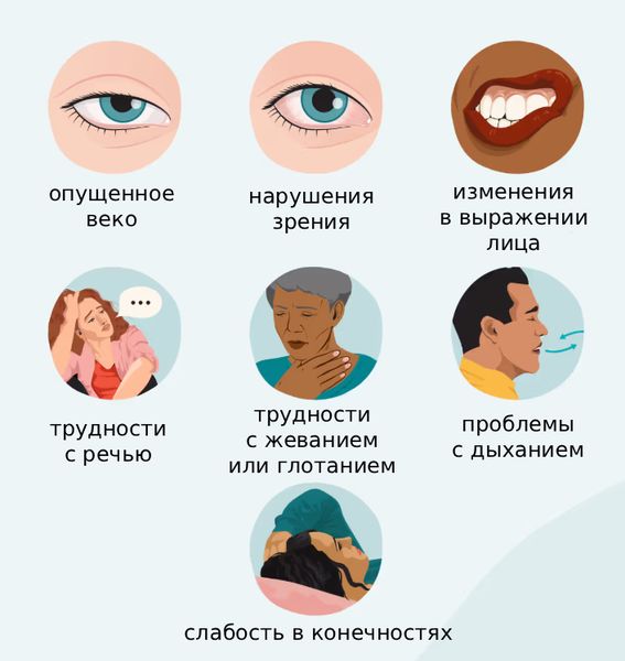 Основные симптомы миастении