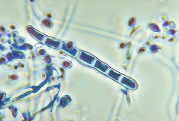 gribok trichophyton rubrum pod mikroskopom s