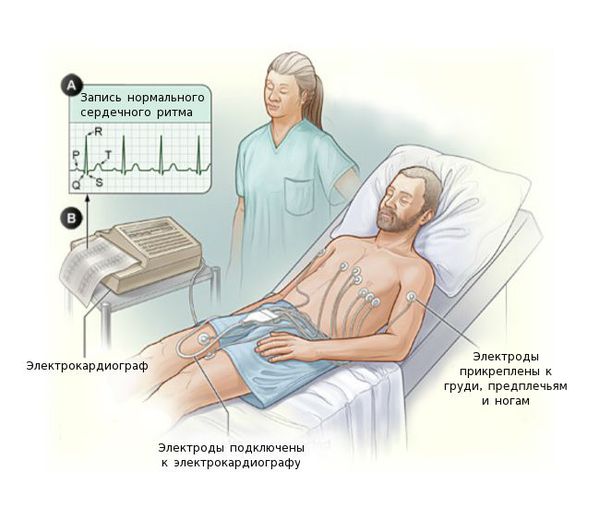 elektrokardiografiya s