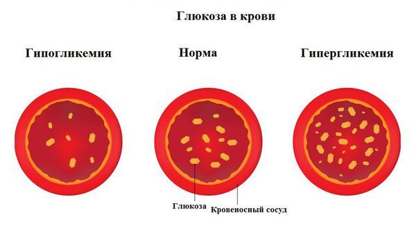 Уровень глюкозы в крови