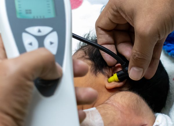 Аудиометрия