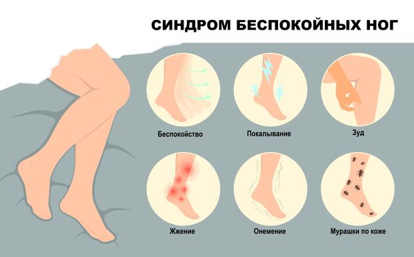 Синдром беспокойных ног Синдром беспокойных ног