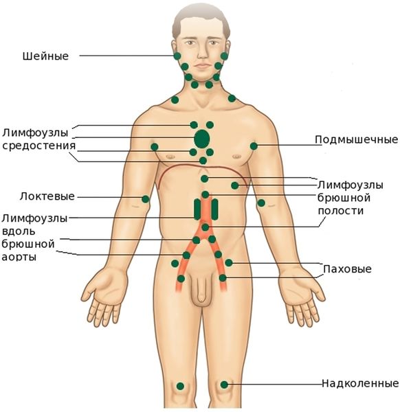 Краснуха - симптомы, причины и лечение