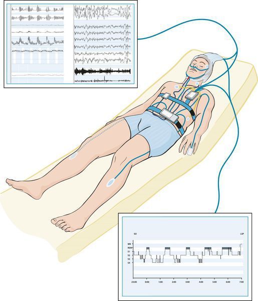 Полисомнография 
