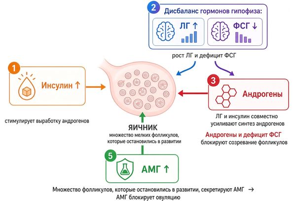 Влияние гормонов на овуляцию при СПКЯ