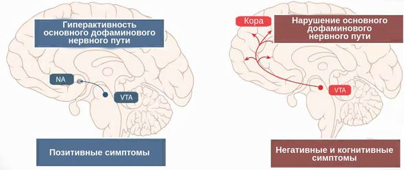 Острое психотическое расстройство (психоз)