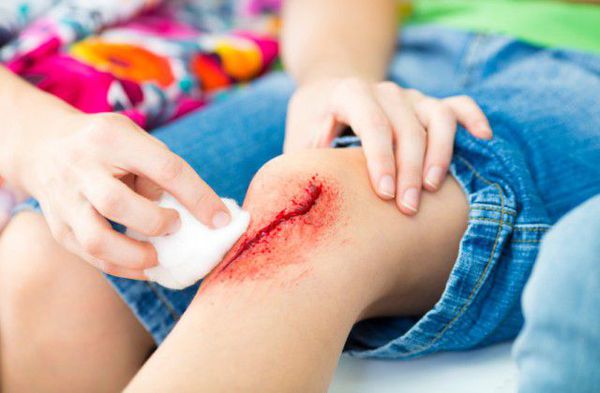 Что относят к ранам мягких тканей?