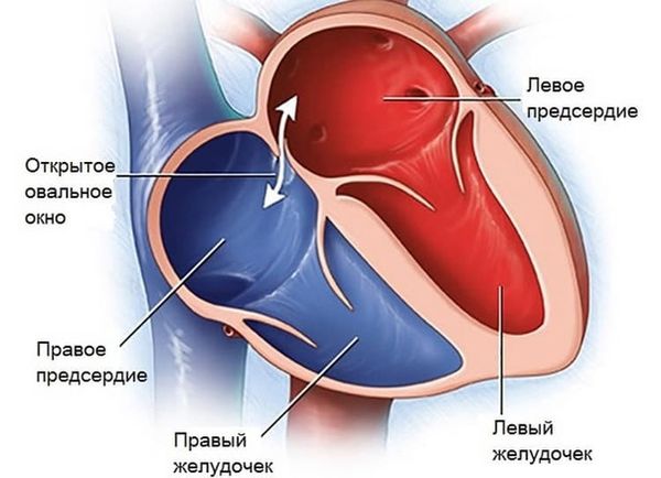 Шум в сердце – статьи о здоровье