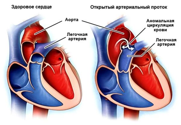 Кровообращение плода: мать и ребенок – единая система