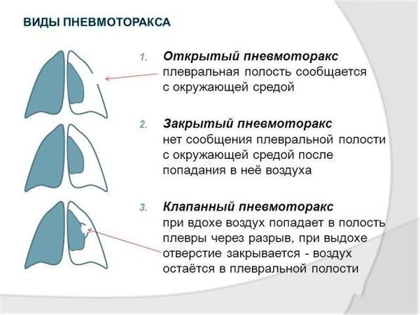 Типы одышки и причины ее возникновения