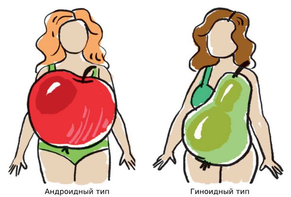 Гиноидный или андроидный типы ожирения