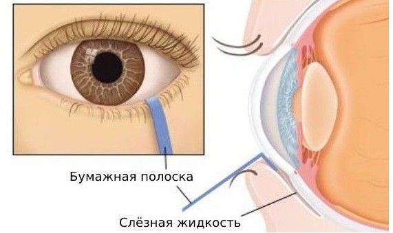 Проба Ширмера